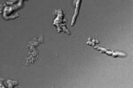 Imagem microscópica de amebas