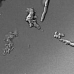 Imagem microscópica de amebas
