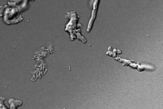Imagem microscópica de amebas