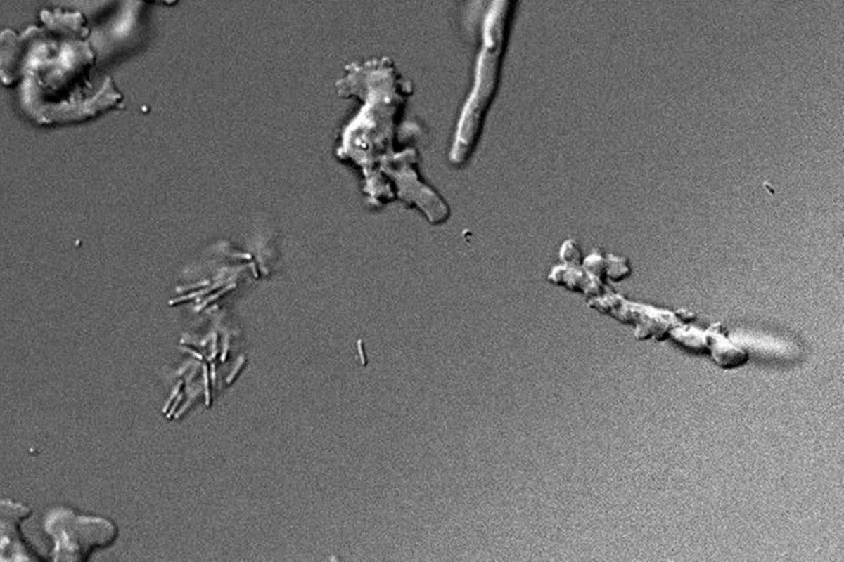 Imagem microscópica de amebas