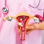 Modelo do sistema reprodutor feminino em consulta médica