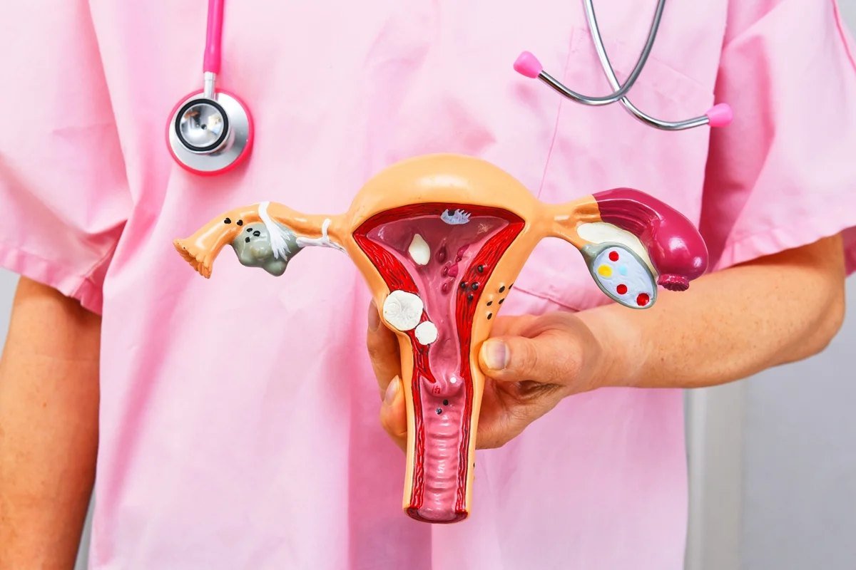 Modelo do sistema reprodutor feminino em consulta médica