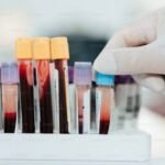 Tubos de amostras de sangue em laboratório