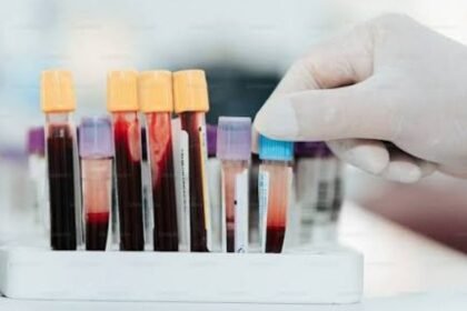 Tubos de amostras de sangue em laboratório