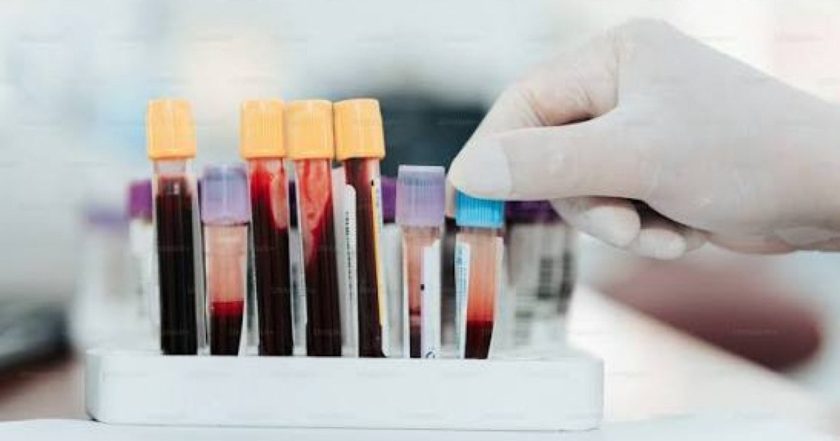 Tubos de amostras de sangue em laboratório