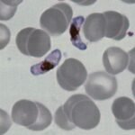 Glóbulos vermelhos infectados pelo parasita da malária vistos ao microscópio